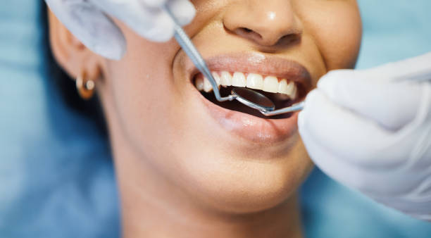 Best Emergency Dentist for Lost Fillings or Crowns in Sea Breeze, NC